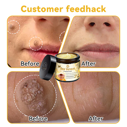 Bee Venom Skin Treatment Cream