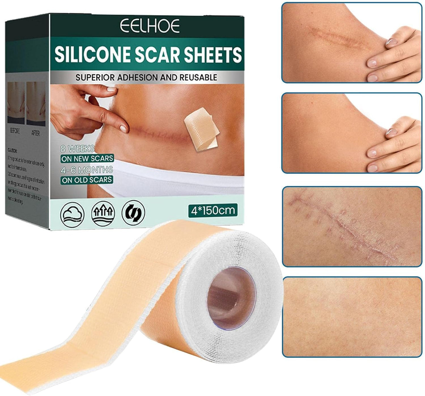 Professional Silicone Scar Tape Roll