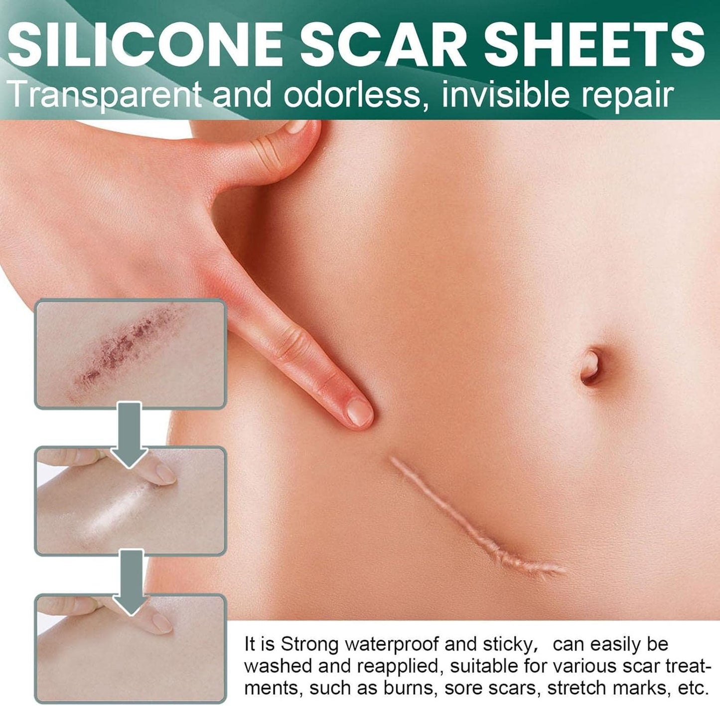 Professional Silicone Scar Tape Roll